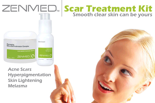 get rof of acne scars